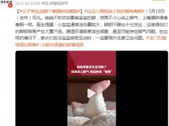 女子亲宝宝脚丫嘴唇肿成香肠 医生提醒这类互动暗藏风险