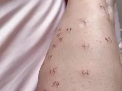 女子双腿被叮126个包 将生活中的小“灾难”变成了全网共鸣的轻松段子！