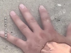 男子手伸海水被虫咬如刀扎 网友好奇:这种芝麻大小的虫子究竟是什么?
